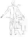 Fig. 02 - Devices and methods for perfusion therapy