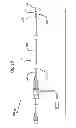 Fig. 11 - Devices and methods for perfusion therapy