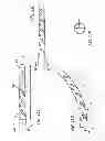 Fig. 14 - Devices and methods for perfusion therapy