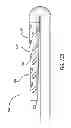 Fig. 18 - Devices and methods for perfusion therapy
