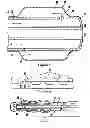 Fig. 03 - Method for a central venous line catheter having a temperature control system