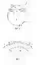 Fig. 02 - Automatic centration of a surgical pattern on the apex of a curved patient interface