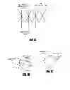 Fig. 03 - Methods and apparatus for introducing tumescent fluid to body tissue