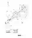 Fig. 05 - Methods and apparatus for introducing tumescent fluid to body tissue