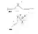 Fig. 07 - Methods and apparatus for introducing tumescent fluid to body tissue