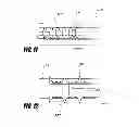 Fig. 12 - Methods and apparatus for introducing tumescent fluid to body tissue