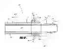 Fig. 13 - Methods and apparatus for introducing tumescent fluid to body tissue