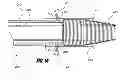 Fig. 14 - Methods and apparatus for introducing tumescent fluid to body tissue