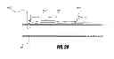 Fig. 18 - Methods and apparatus for introducing tumescent fluid to body tissue