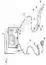 Fig. 02 - Electrosurgical wand and related method and system