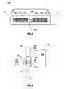 Fig. 04 - Electrosurgical wand and related method and system