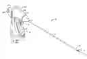 Fig. 01 - Flexible endoscopic catheter with ligasure