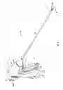 Fig. 02 - Flexible endoscopic catheter with ligasure