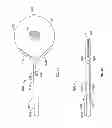 Fig. 06 - Flexible endoscopic catheter with ligasure