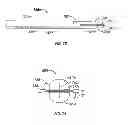 Fig. 07 - Flexible endoscopic catheter with ligasure