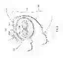 Fig. 03 - Systems and methods for sternum repair