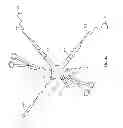 Fig. 09 - Systems and methods for sternum repair