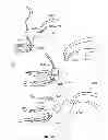 Fig. 32 - Systems and methods for sternum repair