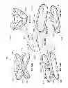 Fig. 34 - Systems and methods for sternum repair