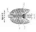 Fig. 35 - Systems and methods for sternum repair