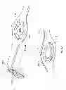Fig. 43 - Systems and methods for sternum repair
