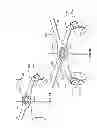 Fig. 44 - Systems and methods for sternum repair