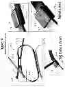 Fig. 49 - Systems and methods for sternum repair
