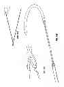 Fig. 68 - Systems and methods for sternum repair