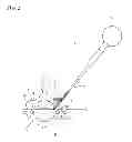 Fig. 03 - Puncture instrument