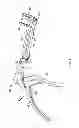 Fig. 02 - Surgical cutting tool