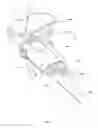 Fig. 07 - Tibial resurfacing system and method