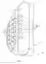 Fig. 12 - Tibial resurfacing system and method