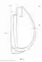 Fig. 16 - Tibial resurfacing system and method
