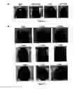 Fig. 05 - Biomaterials containing calcium phosphate