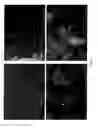 Fig. 06 - Biomaterials containing calcium phosphate