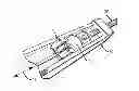 Fig. 01 - Surgical cable tensioning system