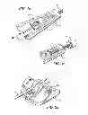 Fig. 02 - Surgical cable tensioning system