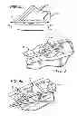 Fig. 03 - Surgical cable tensioning system