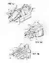 Fig. 04 - Surgical cable tensioning system
