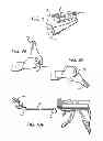 Fig. 08 - Surgical cable tensioning system