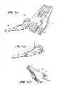 Fig. 09 - Surgical cable tensioning system