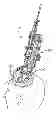 Fig. 01 - Medical device anchoring apparatus and methods