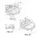 Fig. 03 - Medical device anchoring apparatus and methods