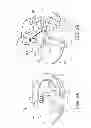 Fig. 04 - Medical device anchoring apparatus and methods