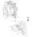 Fig. 08 - Medical device anchoring apparatus and methods