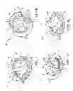 Fig. 09 - Medical device anchoring apparatus and methods