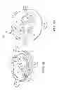 Fig. 10 - Medical device anchoring apparatus and methods