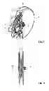 Fig. 02 - Occluder