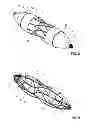 Fig. 06 - Occluder