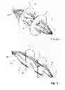 Fig. 07 - Occluder
